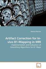 Artifact Correction for In-vivo B1-Mapping in MRI: Implementation and Evaluation of Smoothing Algorithms for B1 Maps