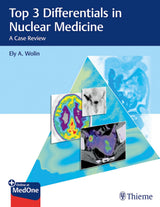 Top 3 Differentials in Nuclear Medicine: A Case Review