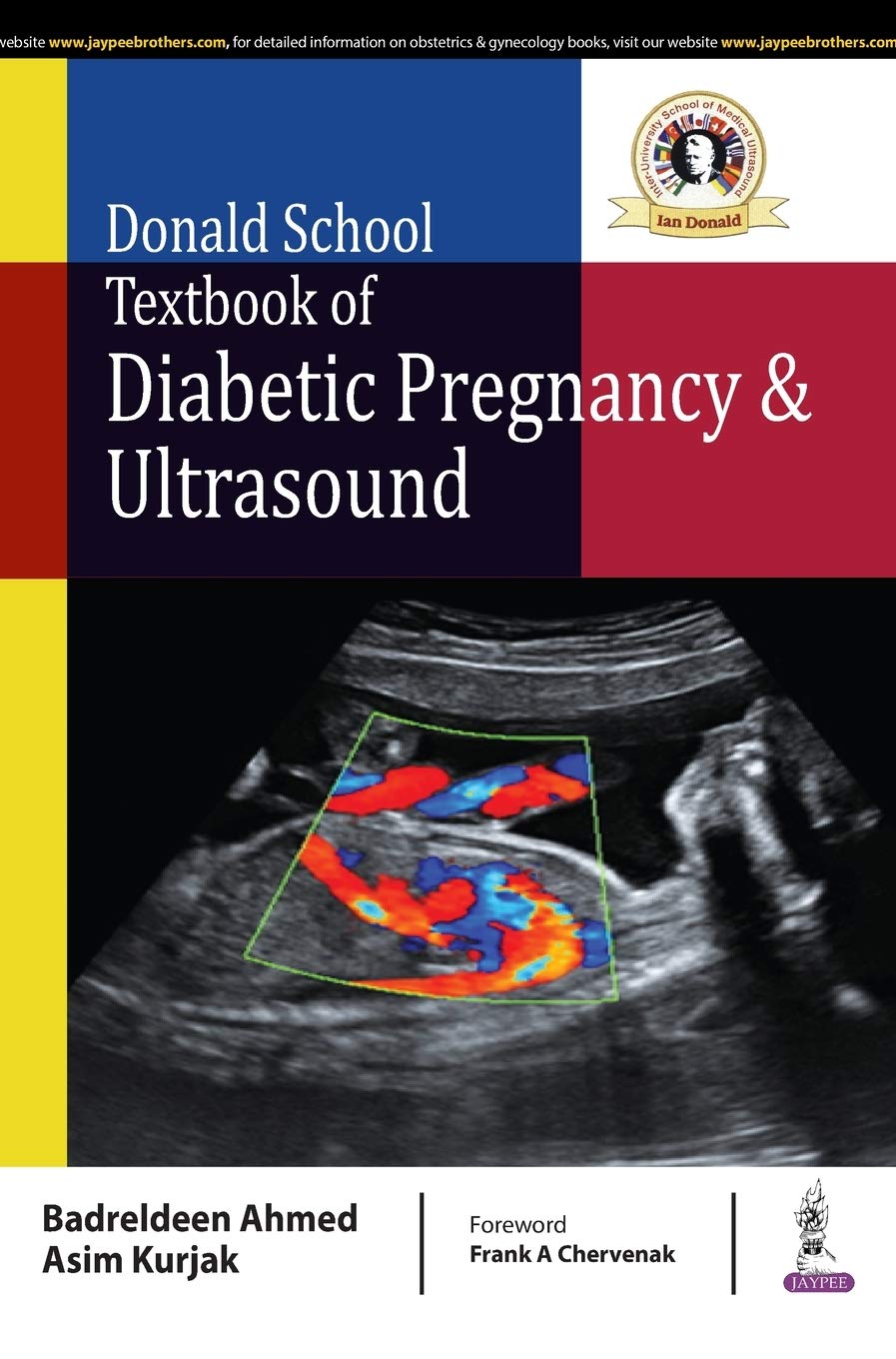 Donald School Textbook of Diabetic Pregnancy & Ultrasound: 1st Edition