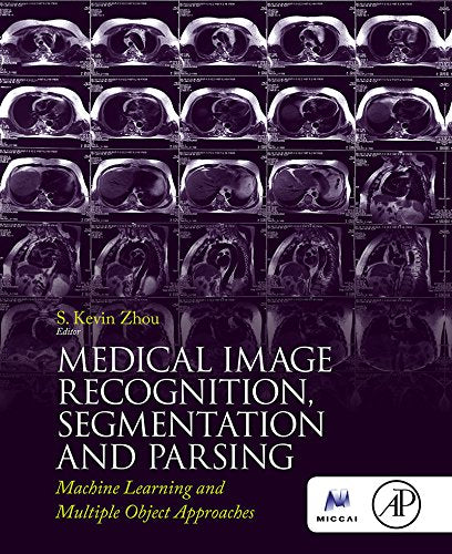 Medical Image Recognition, Segmentation and Parsing: Machine Learning and Multiple Object Approaches (The MICCAI Society book Series)