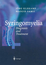 Syringomyelia: Diagnosis and Treatment