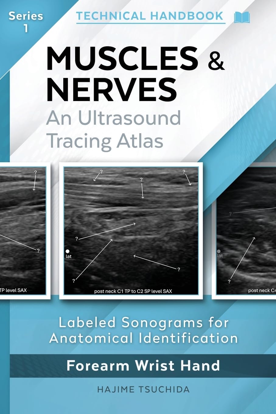 Muscles & Nerves - Technical Ultrasound Handbook: An Ultrasound Tracing Atlas (Series 1) (Technical Ultrasound Handbook - Muscles & Nerves: An Ultrasound Tracing Atlas)