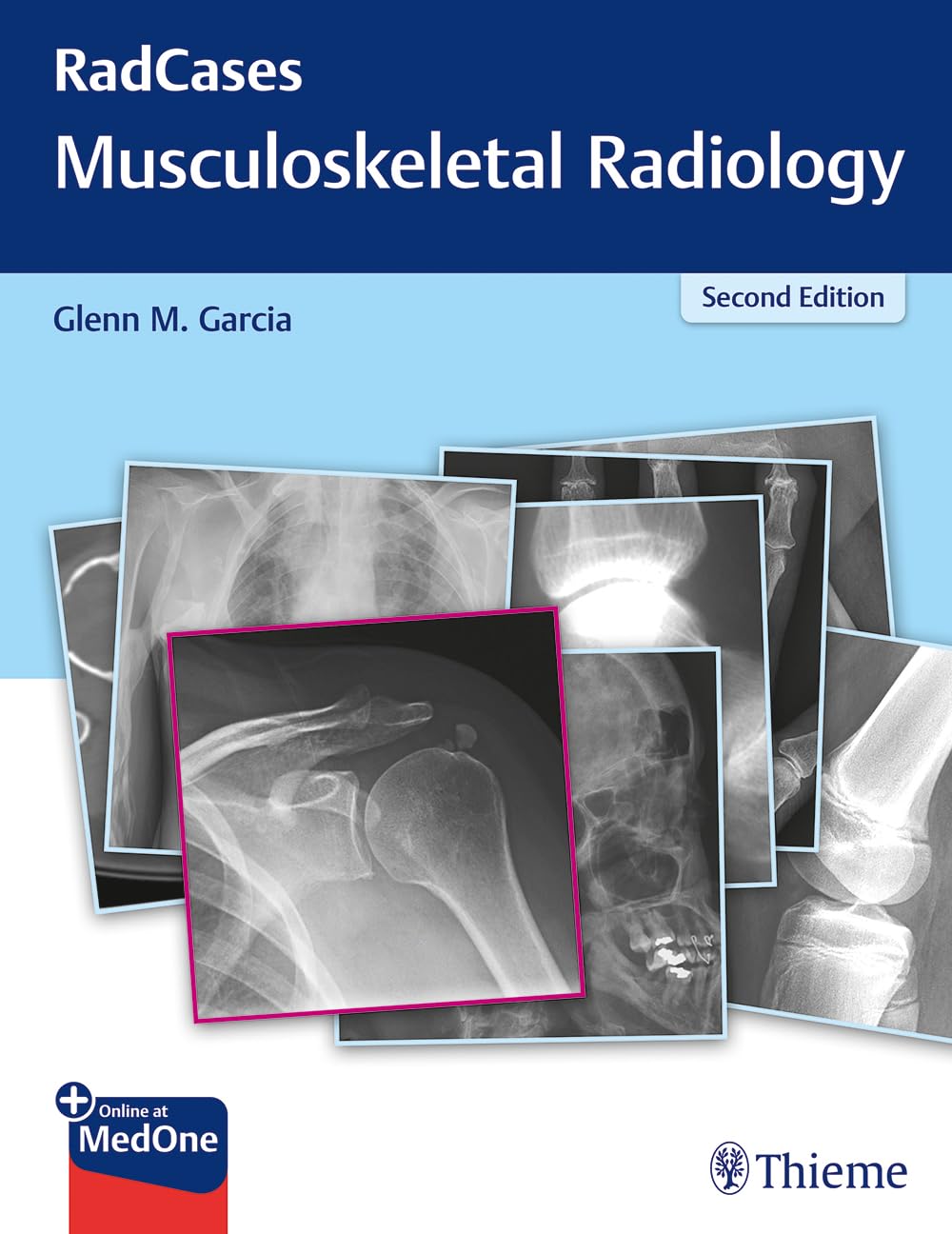 RadCases Q&A Musculoskeletal Radiology (Radcases Plus Q&A): 2nd Edition
