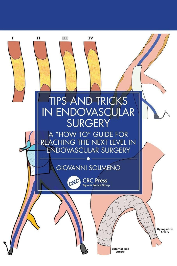 Tips and Tricks in Endovascular Surgery: A "How to" Guide for reaching the next Level in Endovascular Surgery