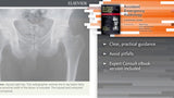 Accident and Emergency Radiology: A Survival Guide