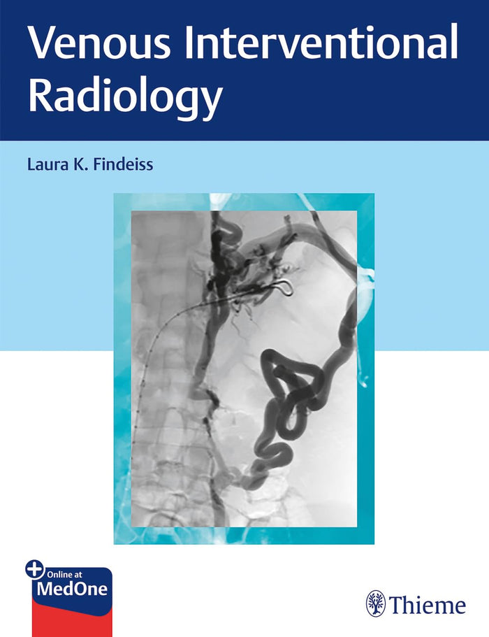 Venous Interventional Radiology: 1st Edition