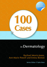 100 Cases in Dermatology: 1st Edition