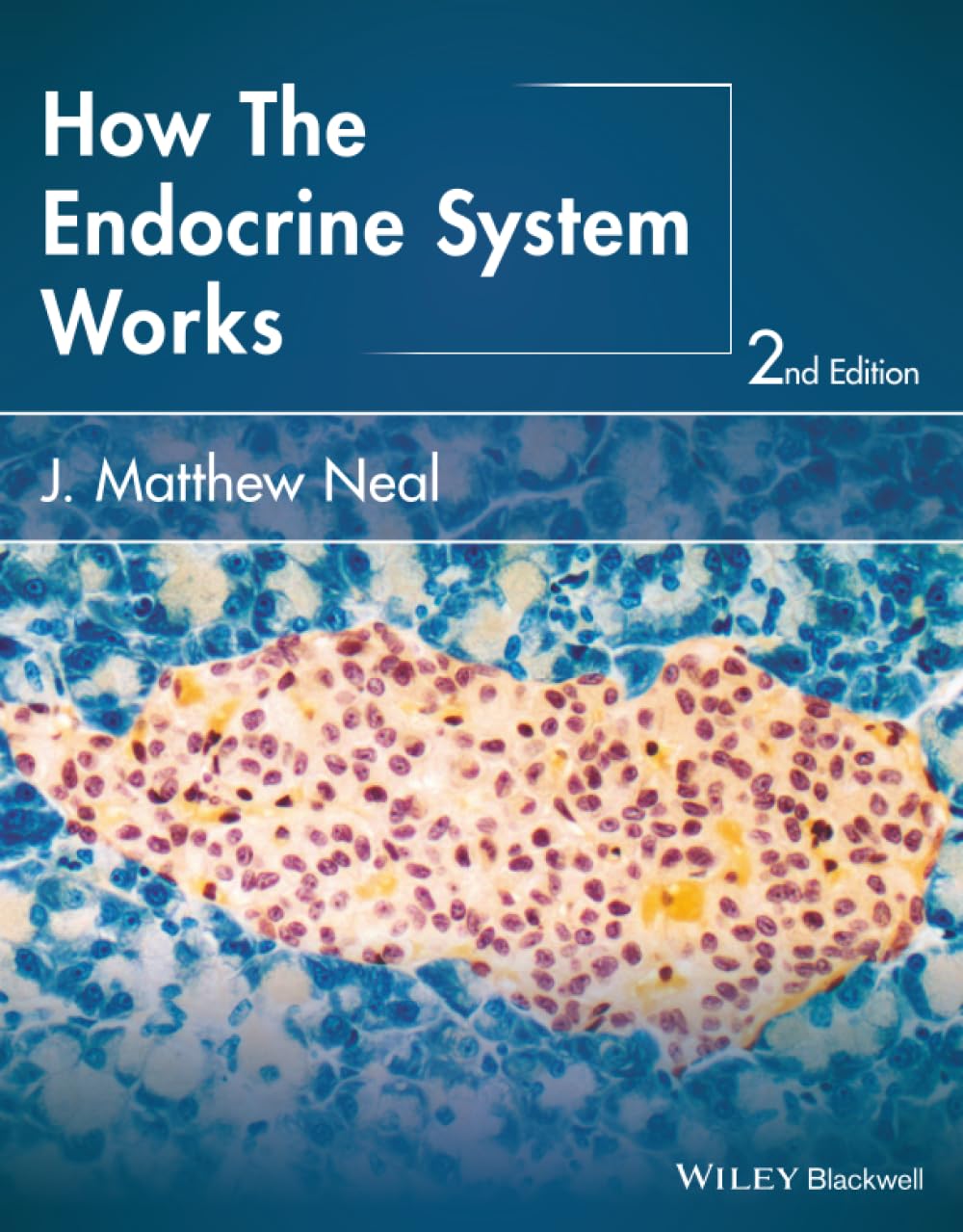 How the Endocrine System Works (The How it Works Series): 2nd Edition