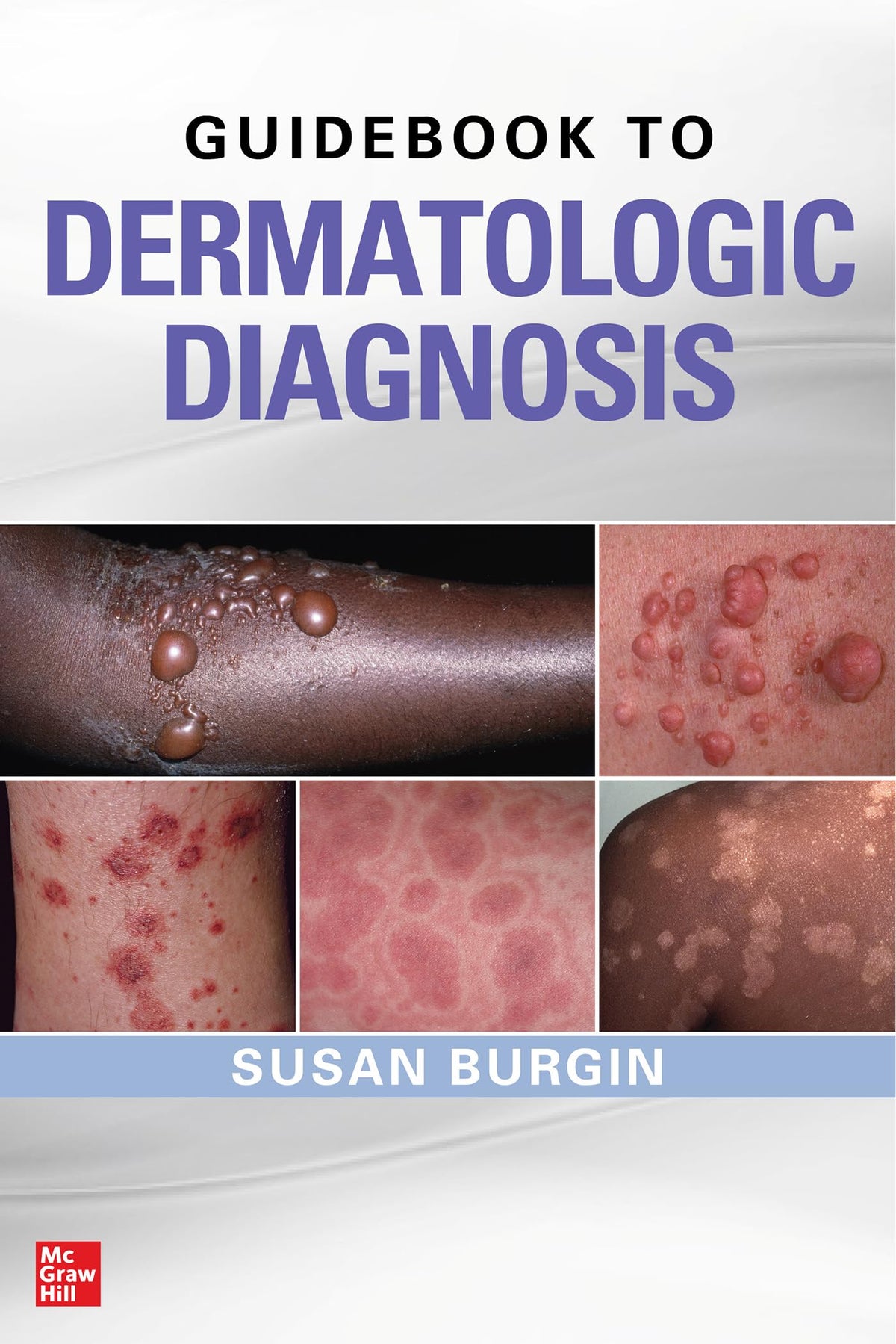 Guidebook to Dermatologic Diagnosis: 1st Edition