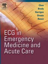 ECG in Emergency Medicine and Acute Care: 1st Edition