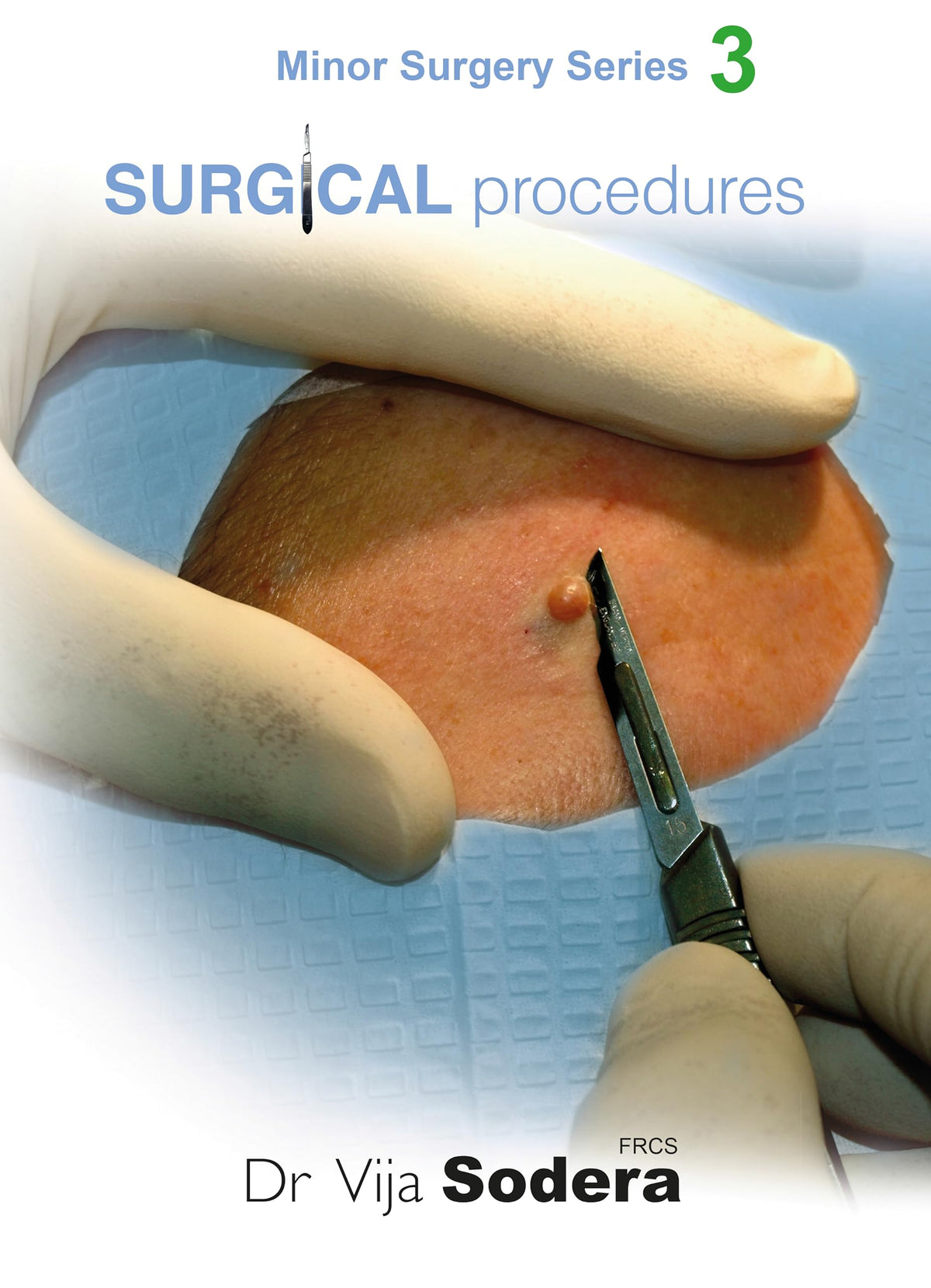 Surgical Procedures (Minor Surgery Series): [Print Replica] Kindle Edition