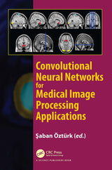 Convolutional Neural Networks for Medical Image Processing Applications: 1st Edition