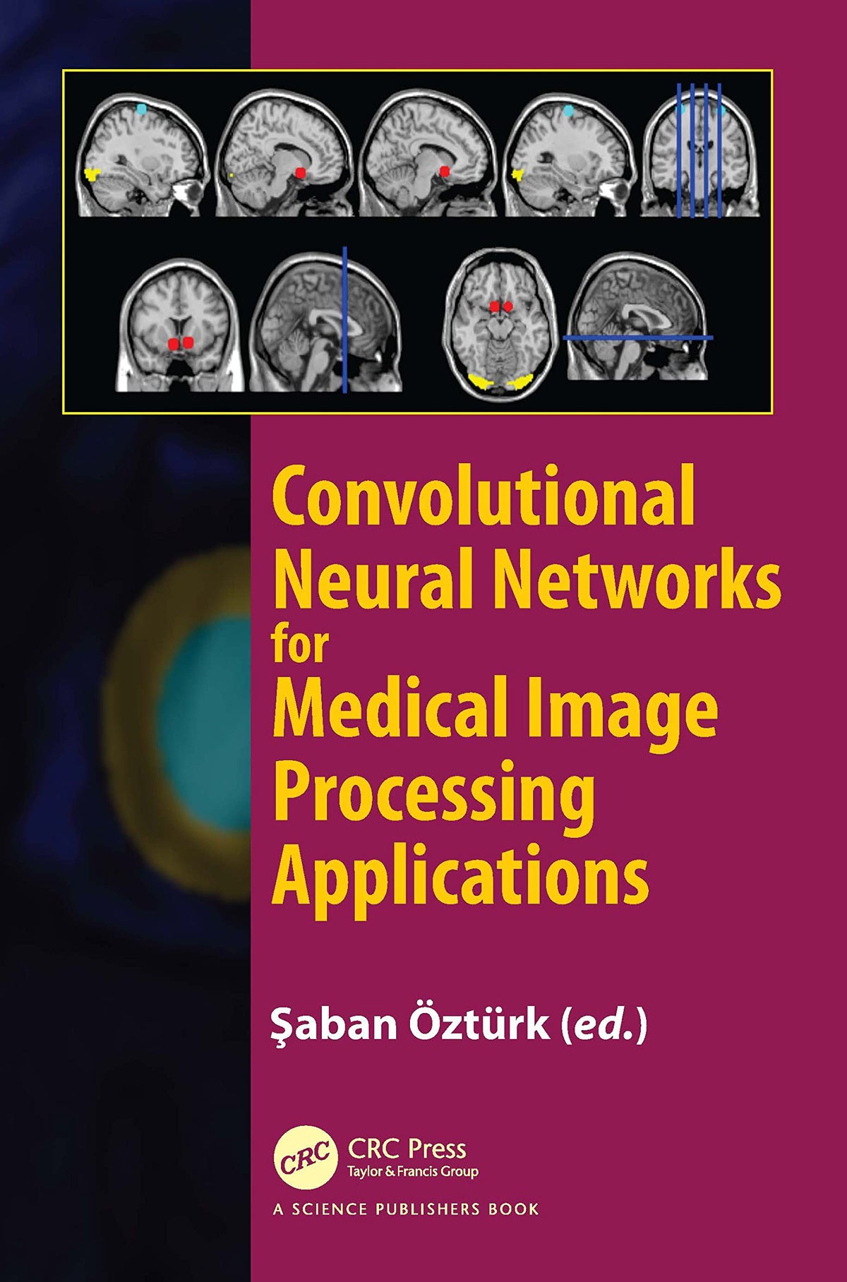 Convolutional Neural Networks for Medical Image Processing Applications: 1st Edition