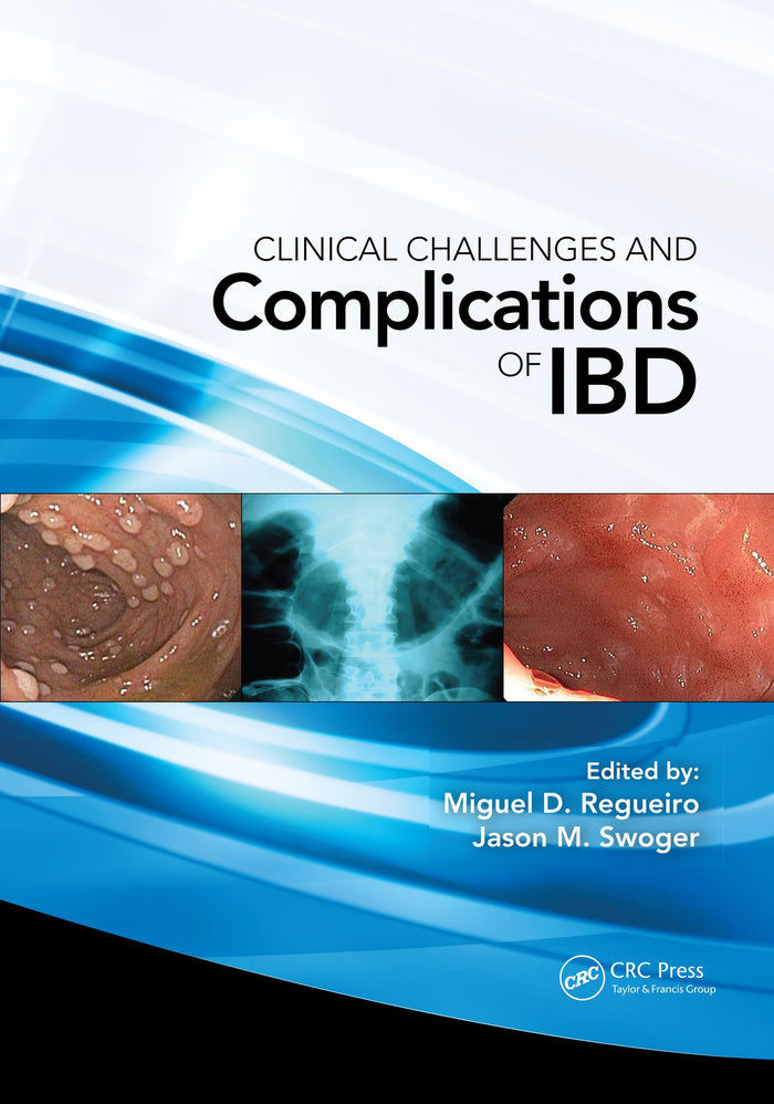 Clinical Challenges and Complications of IBD: 1st Edition