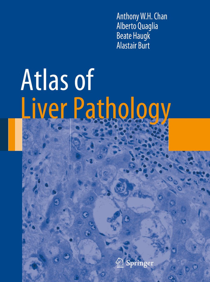 Atlas of Liver Pathology (Atlas of Anatomic Pathology)