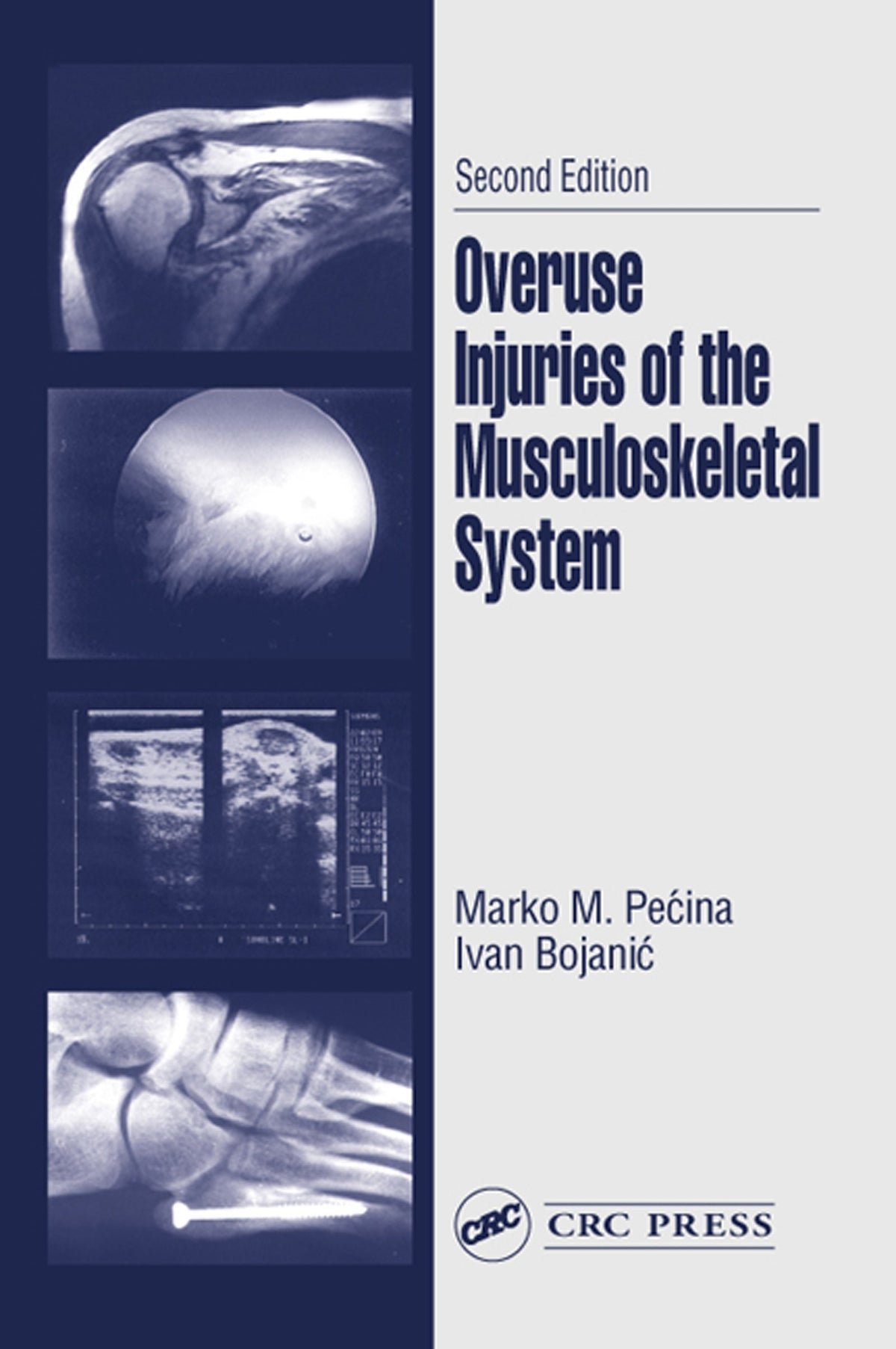 Overuse Injuries of the Musculoskeletal System: 2nd Edition, Kindle Edition