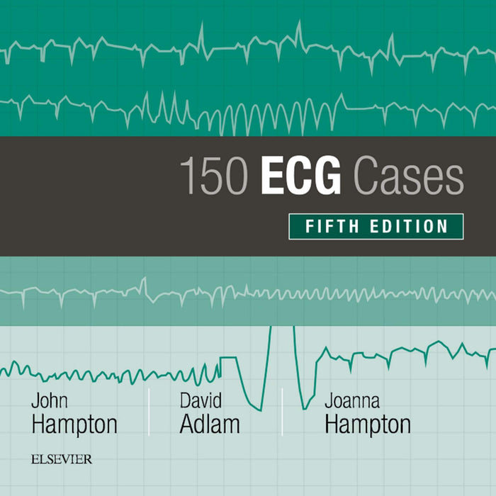 150 ECG Cases: 5th Edition