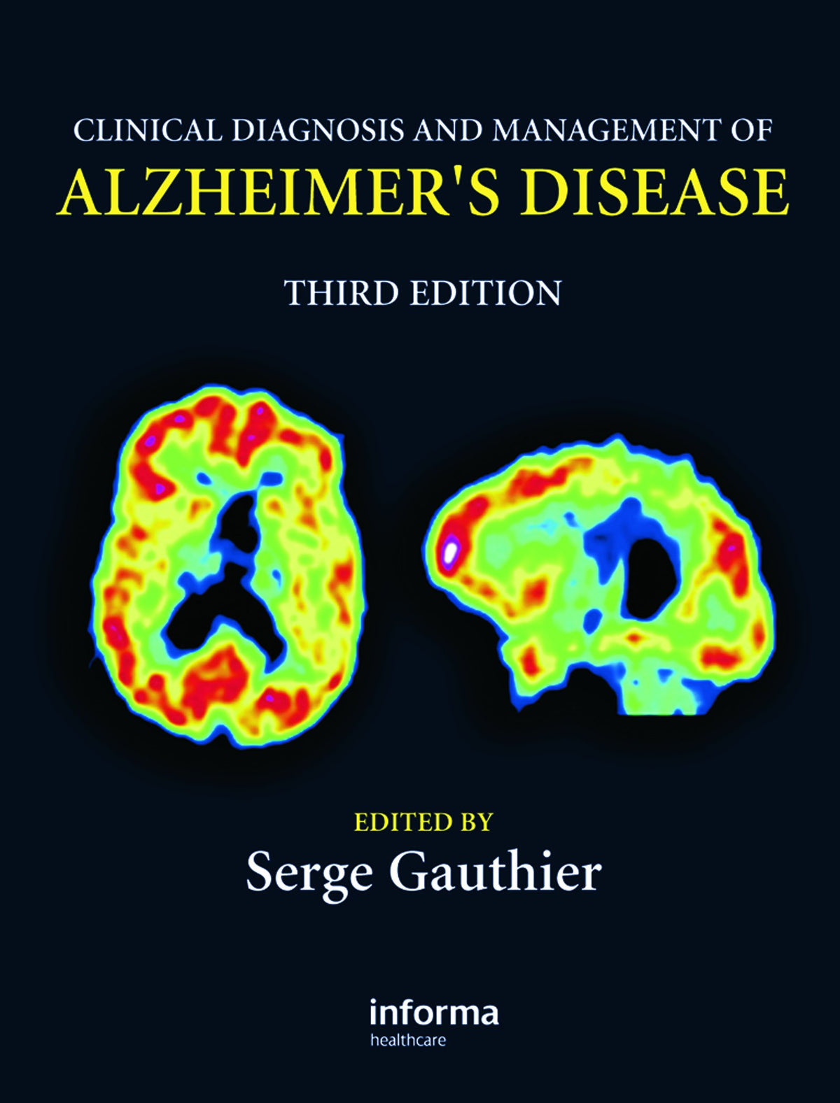 Clinical Diagnosis and Management of Alzheimer's Disease: 3rd Edition
