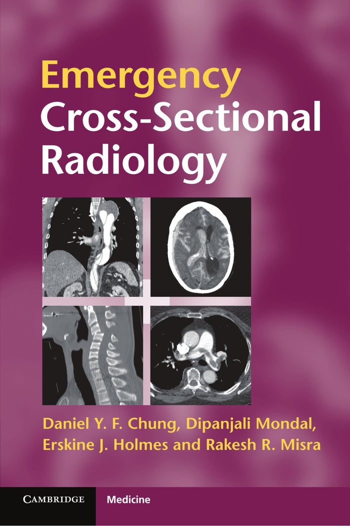 Emergency Cross-sectional Radiology (Cambridge Medicine ()): 1st Edition