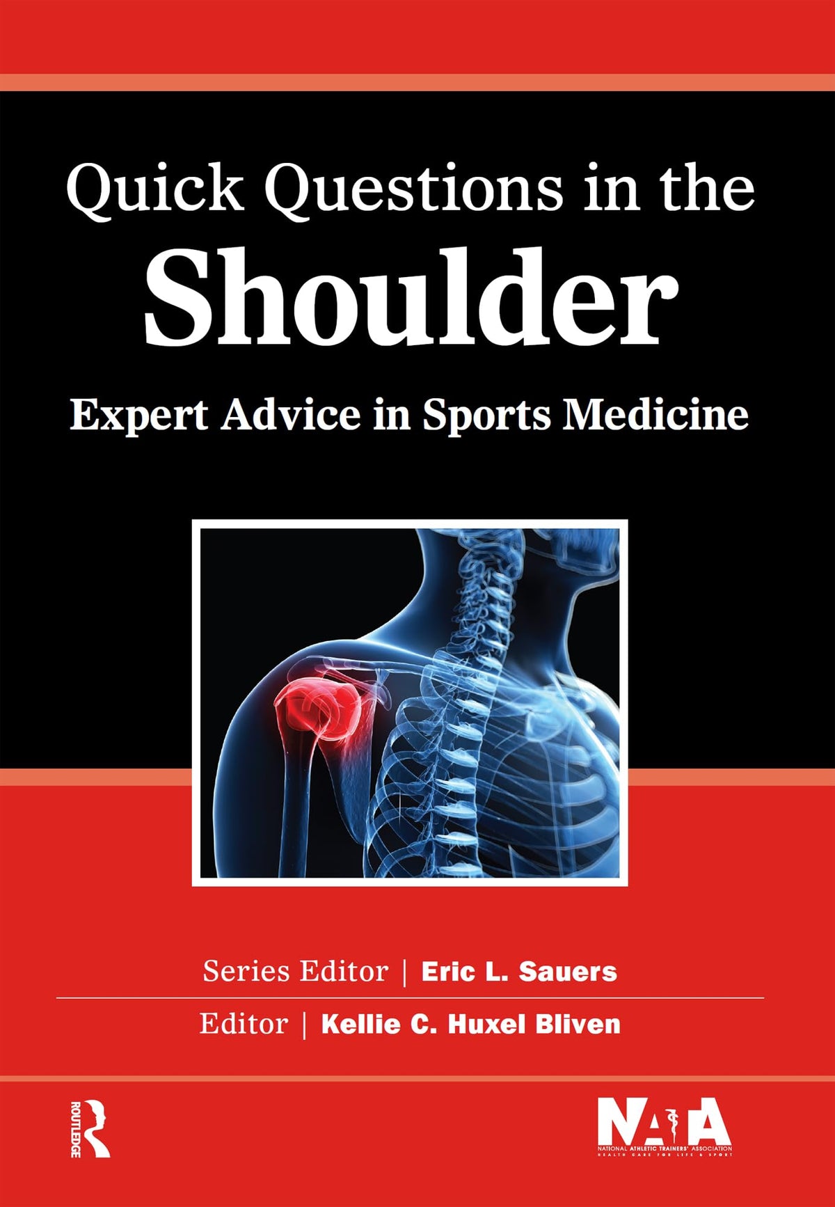 Quick Questions in the Shoulder: Expert Advice in Sports Medicine (Quick Questions in Sports Medicine): 1st Edition, Kindle Edition