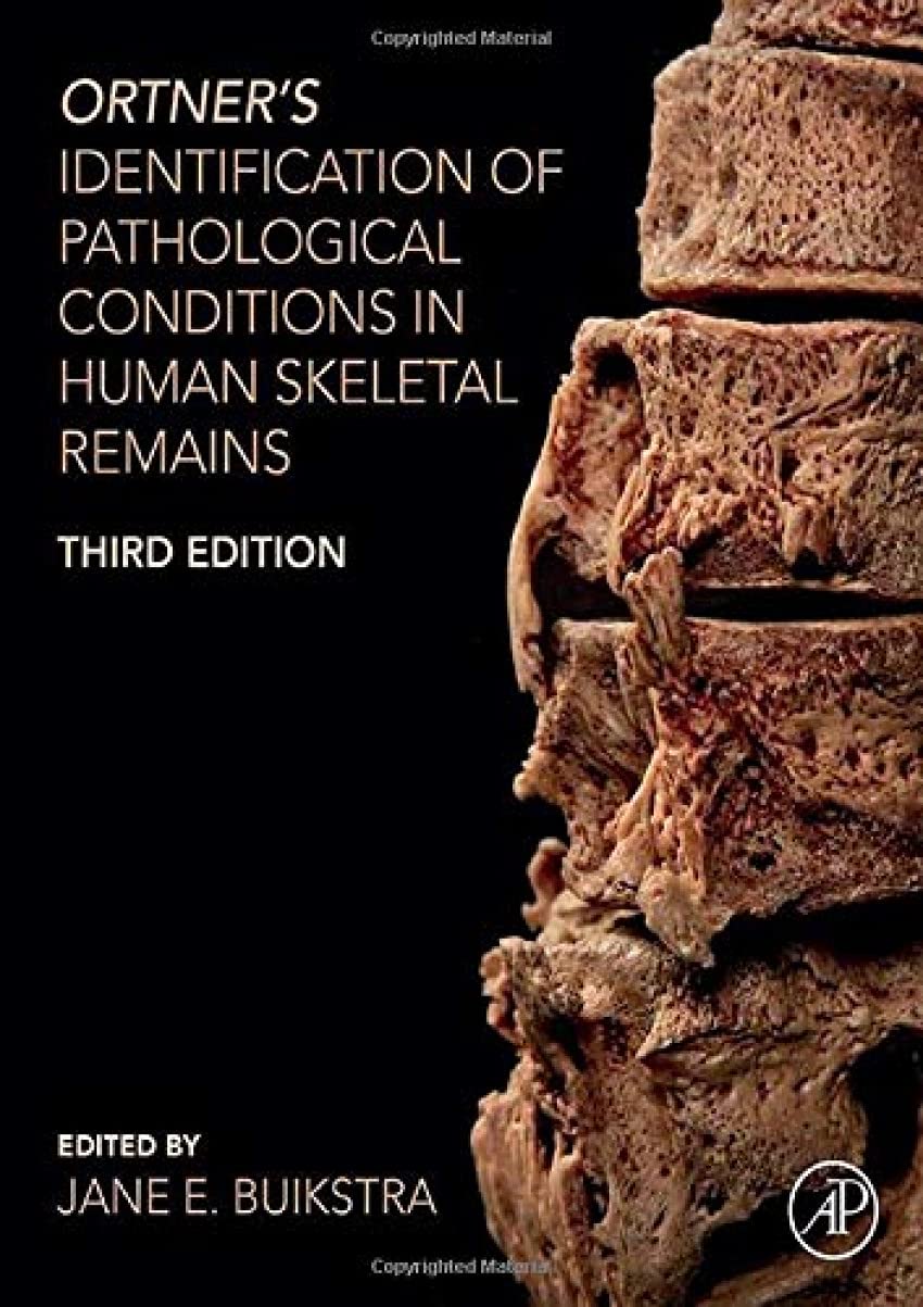 Ortner's Identification of Pathological Conditions in Human Skeletal Remains: 3rd Edition
