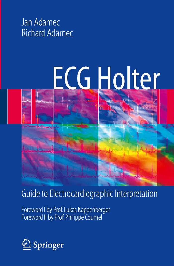 ECG Holter: Guide to Electrocardiographic Interpretation