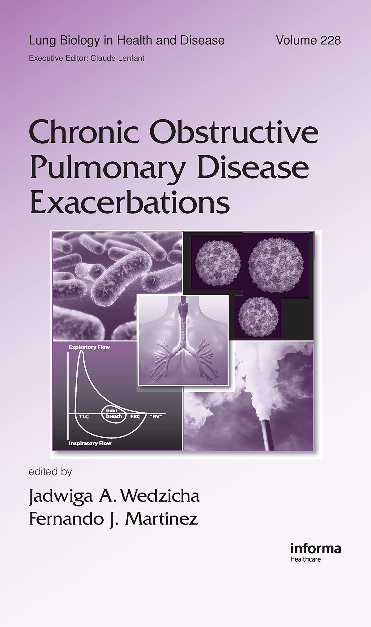 Chronic Obstructive Pulmonary Disease Exacerbations (Lung Biology in Health and Disease): 1st Edition