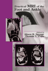 Practical MRI of the Foot and Ankle: 1st Edition