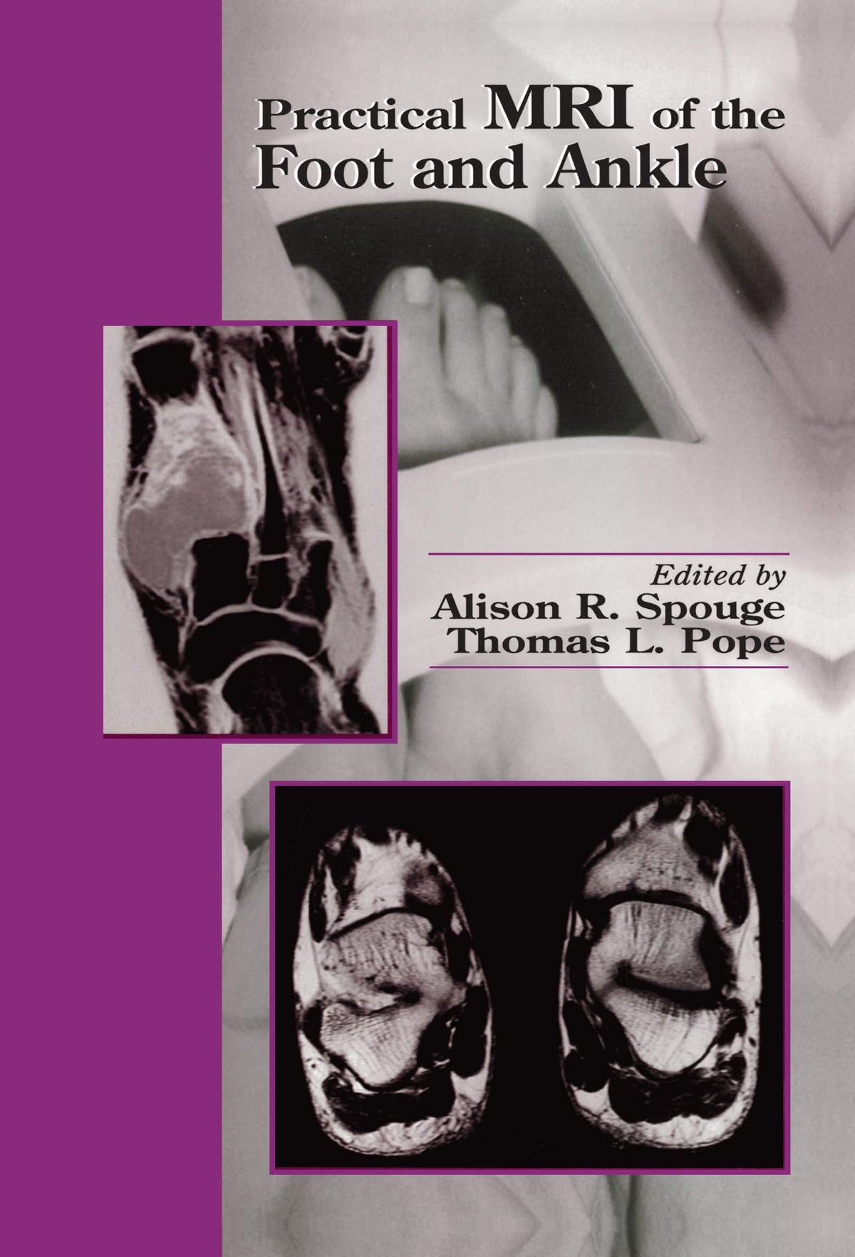 Practical MRI of the Foot and Ankle: 1st Edition