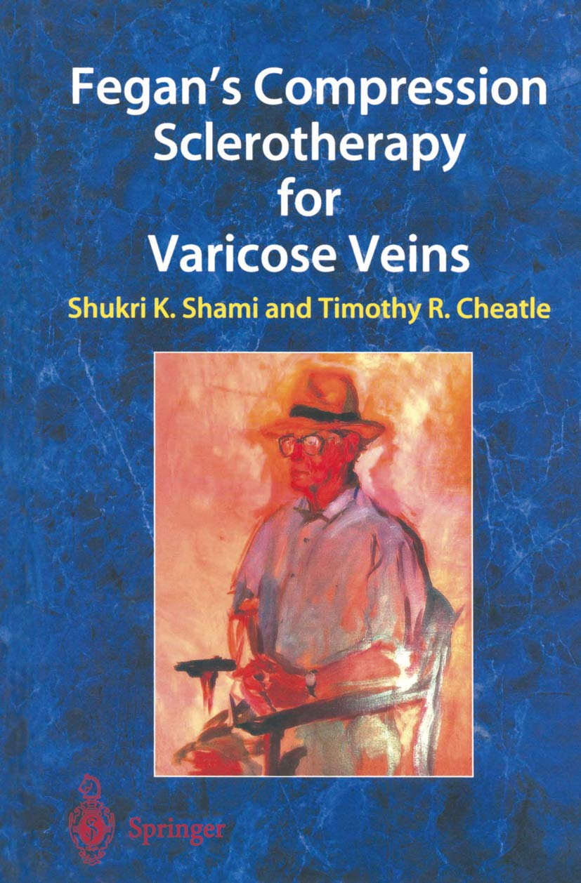 Fegan’s Compression Sclerotherapy for Varicose Veins: 1st Edition