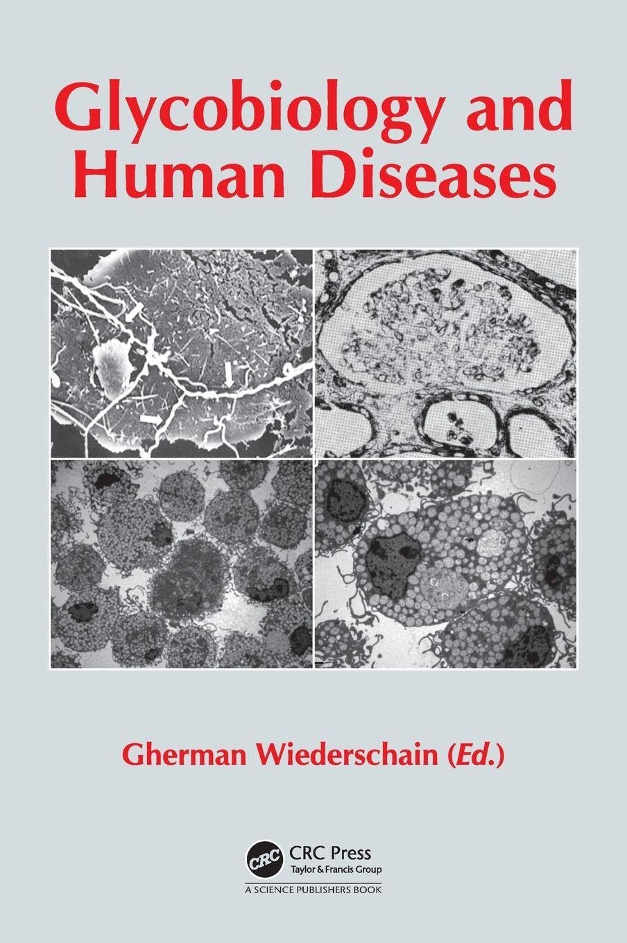 Glycobiology and Human Diseases: 1st Edition
