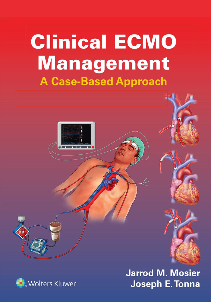 Clinical ECMO Management: A Case-Based Approach