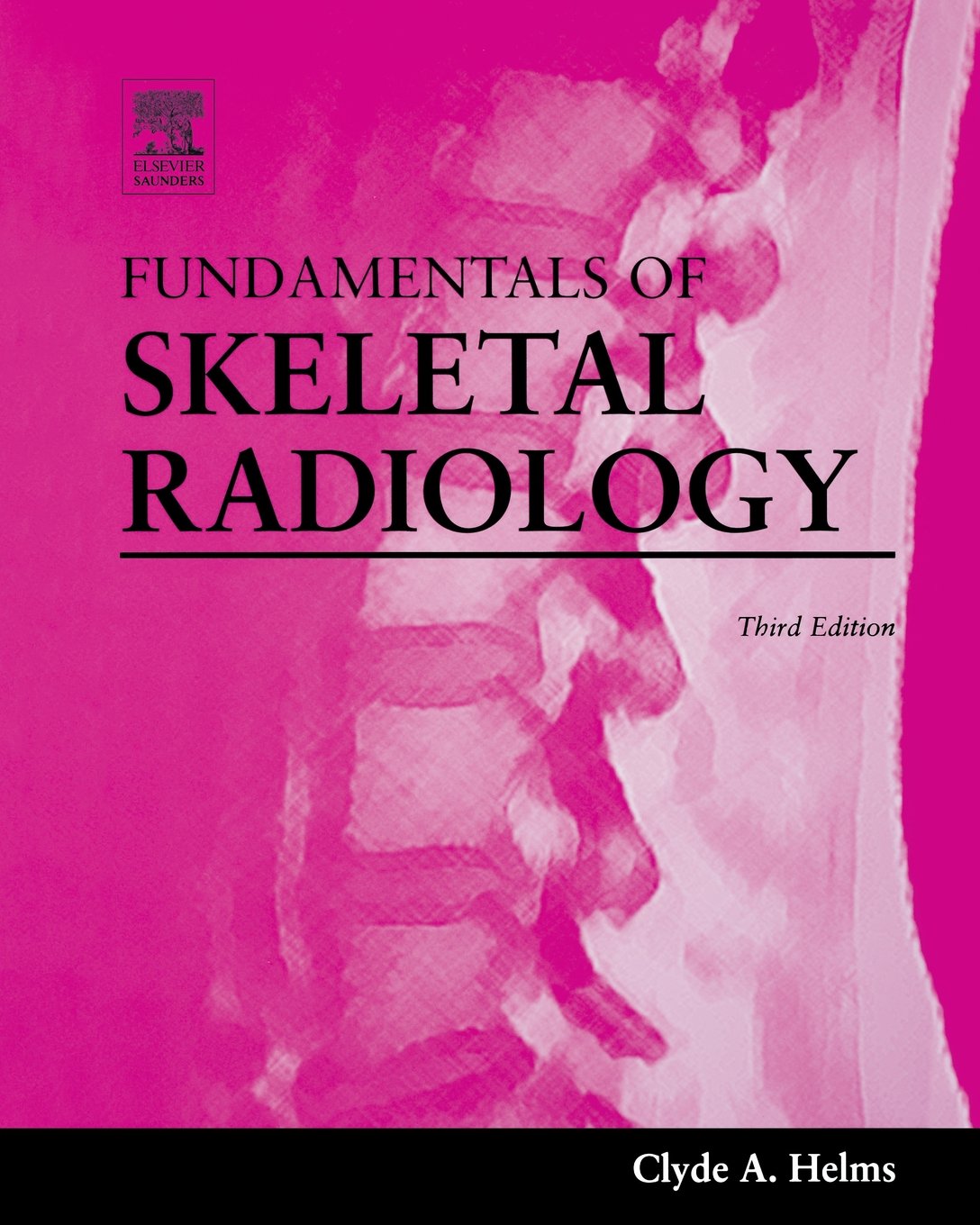 Fundamentals of Skeletal Radiology: 3rd Edition