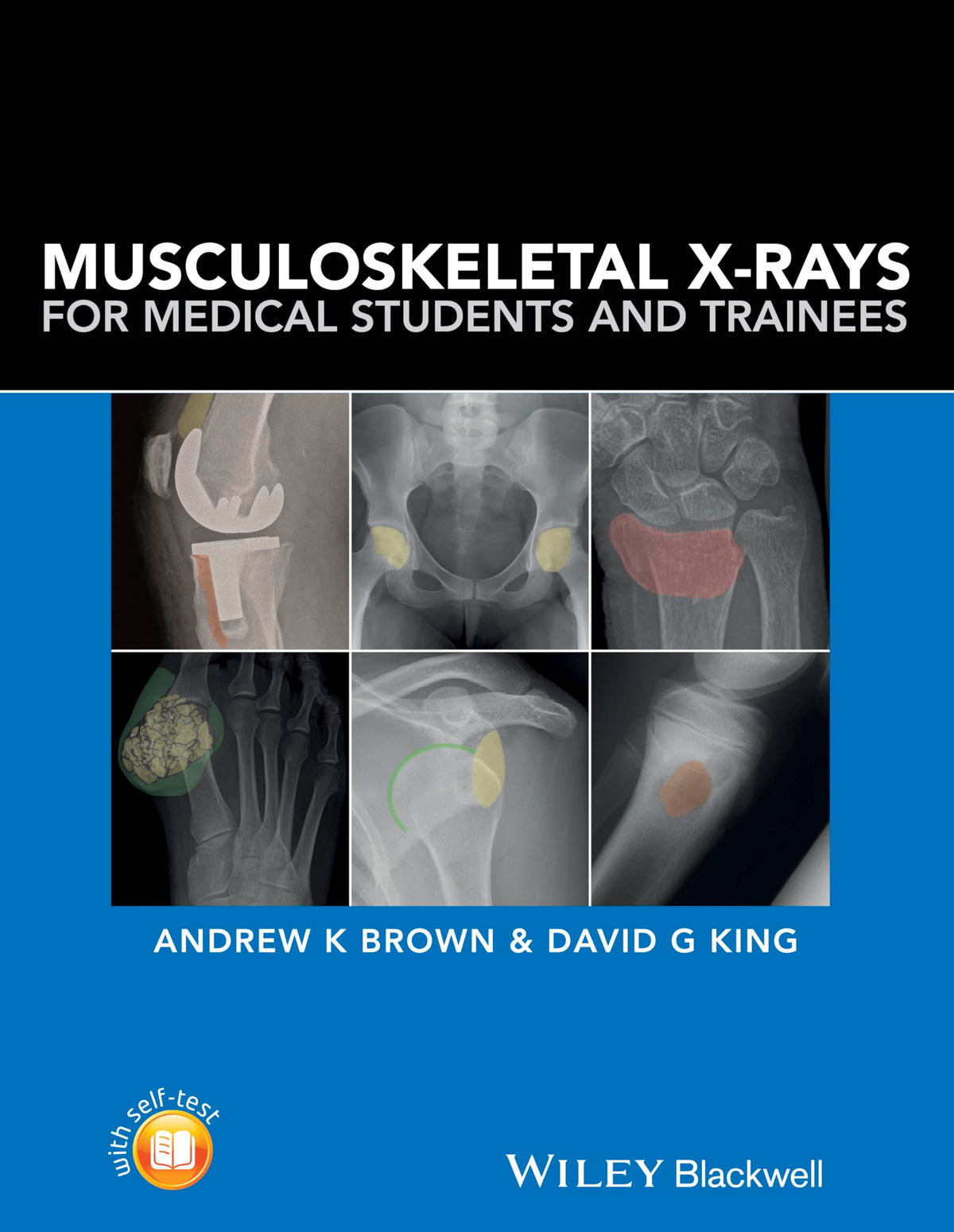 Musculoskeletal X-Rays for Medical Students and Trainees: 1st Edition