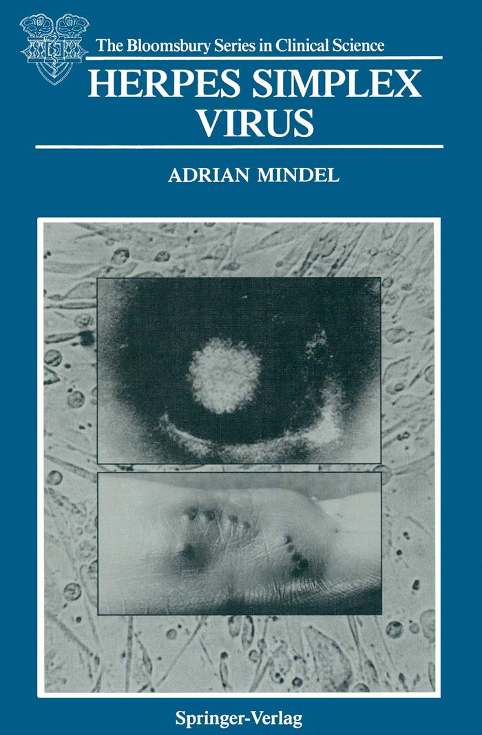 Herpes Simplex Virus (The Bloomsbury Series in Clinical Science): 1st Edition