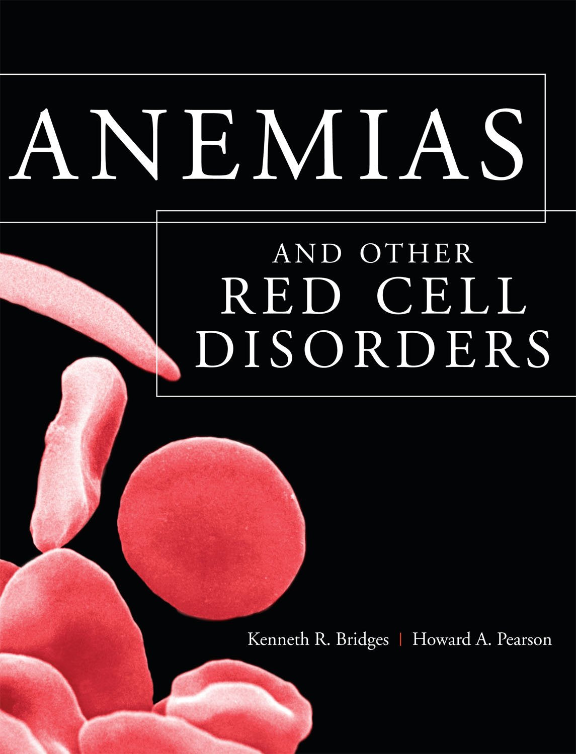 Anemias and Other Red Cell Disorders: 1st Edition