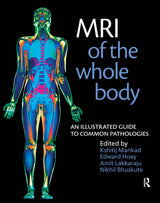 MRI of the Whole Body: An Illustrated Guide for Common Pathologies: 1/E Edition