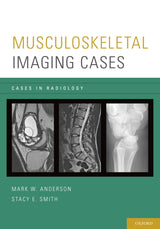 Musculoskeletal Imaging Cases in Radiology): 1st Edition