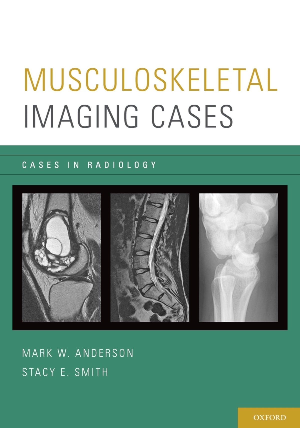 Musculoskeletal Imaging Cases in Radiology): 1st Edition