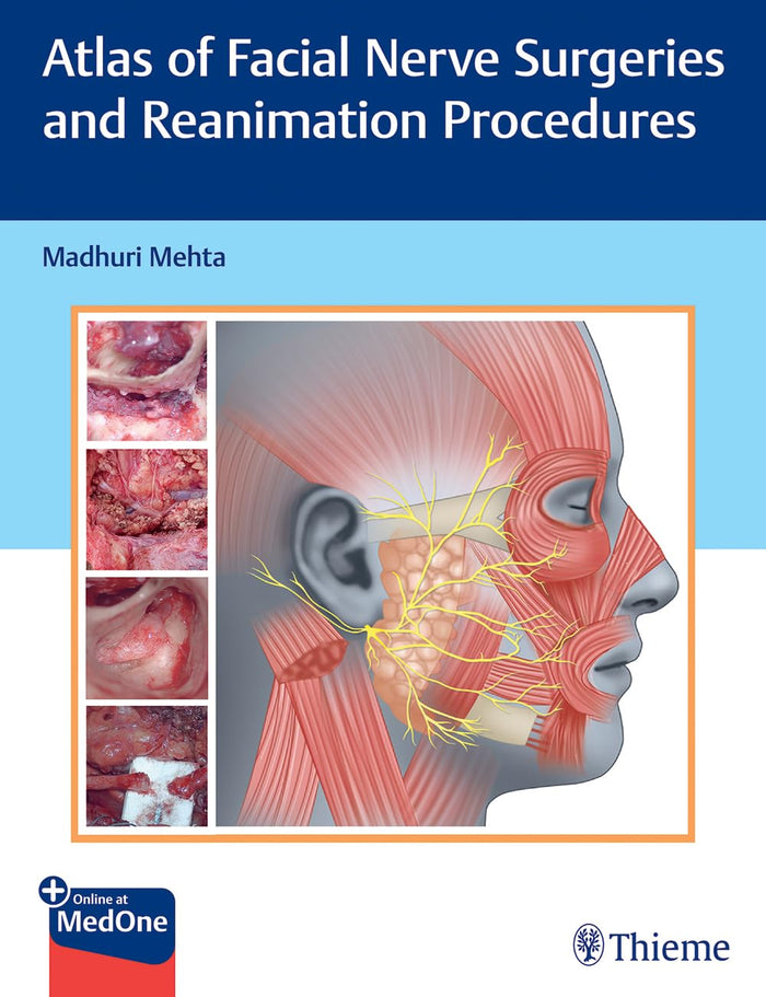 Atlas of Facial Nerve Surgeries and Reanimation Procedures: 1st Edition