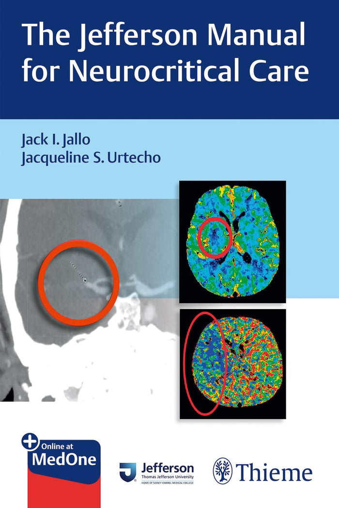 The Jefferson Manual for Neurocritical Care: 1st Edition