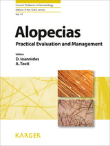 Alopecias - Practical Evaluation and Management (Current Problems in Dermatology Book 47): 1st Edition
