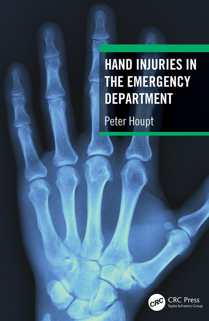 Hand Injuries in the Emergency Department: 1st Edition