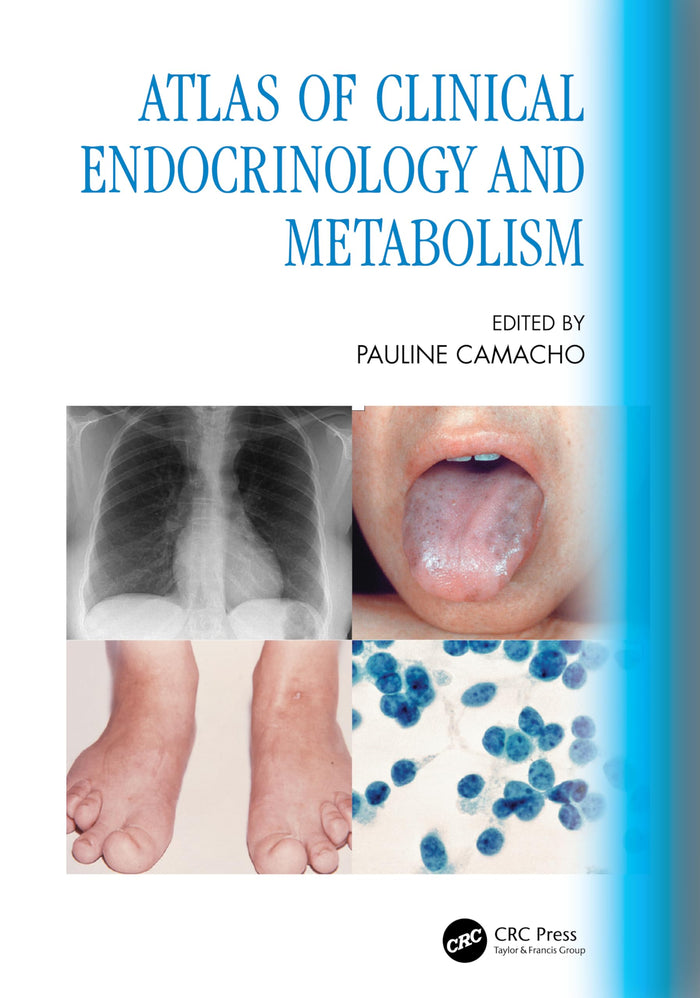 Atlas of Clinical Endocrinology and Metabolism: 1st Edition