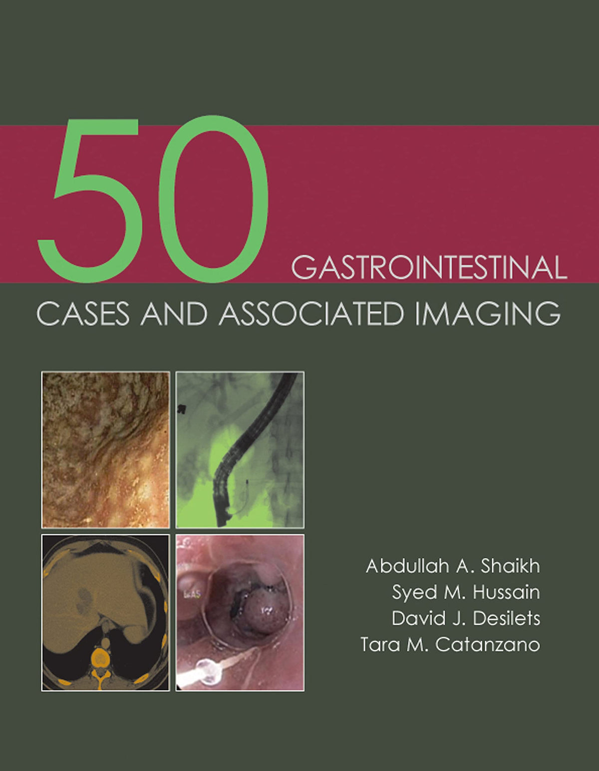50 Gastrointestinal Cases and Associated Imaging: 1st Edition