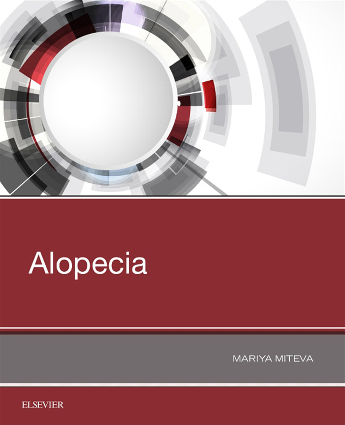 Alopecia: 1st Edition