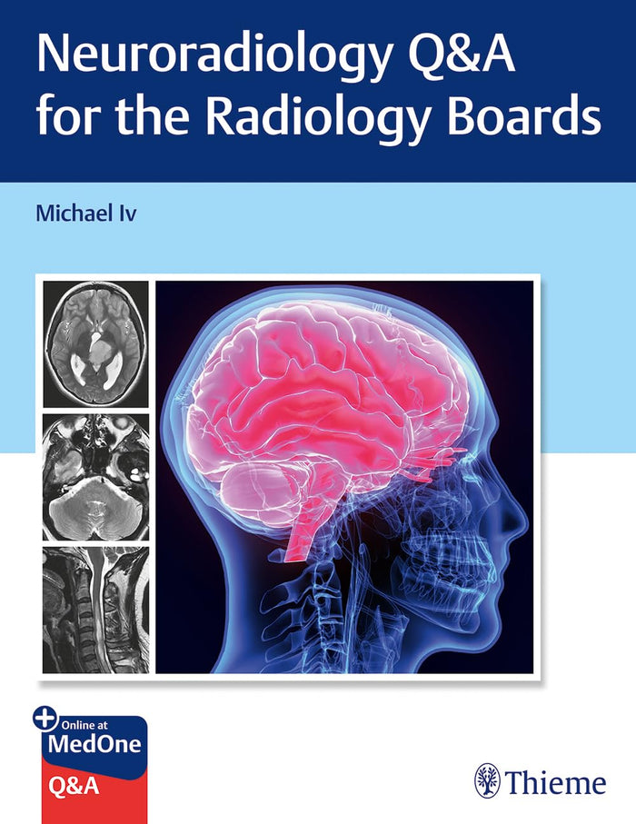 Neuroradiology Q&A for the Radiology Boards: 1st Edition