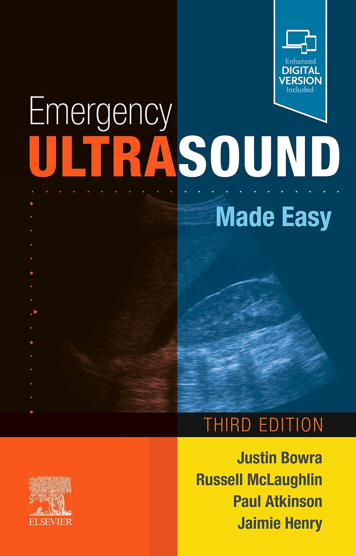 Emergency Ultrasound Made Easy: Emergency Ultrasound Made Easy E-Book