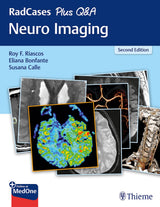 RadCases Plus Q&A Neuro Imaging: 2nd Edition