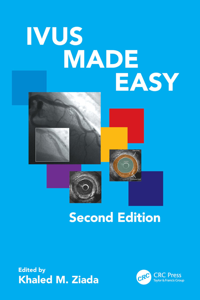 IVUS Made Easy: 2nd Edition